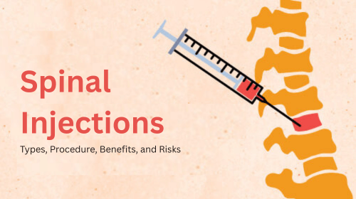حقن العمود الفقري: الأنواع، الإجراءات، الفوائد، والمخاطر